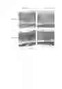 Fig. 11 - Silk fibroin hydrogels and uses thereof