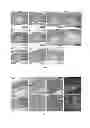 Fig. 12 - Silk fibroin hydrogels and uses thereof