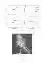 Fig. 16 - Silk fibroin hydrogels and uses thereof