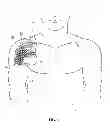 Fig. 17 - Methods and apparatus for delivering and positioning sheet-like materials in surgery