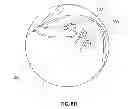 Fig. 24 - Methods and apparatus for delivering and positioning sheet-like materials in surgery