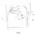 Fig. 25 - Methods and apparatus for delivering and positioning sheet-like materials in surgery