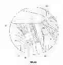 Fig. 30 - Methods and apparatus for delivering and positioning sheet-like materials in surgery