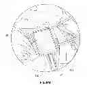 Fig. 33 - Methods and apparatus for delivering and positioning sheet-like materials in surgery