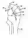 Fig. 01 - Methods for ligament reconstruction