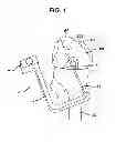 Fig. 02 - Methods for ligament reconstruction