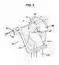 Fig. 03 - Methods for ligament reconstruction