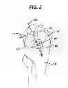Fig. 06 - Methods for ligament reconstruction