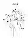 Fig. 07 - Methods for ligament reconstruction