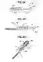 Fig. 10 - Methods for ligament reconstruction