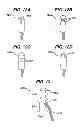 Fig. 12 - Methods for ligament reconstruction