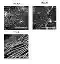 Fig. 07 - Multilayered silk scaffolds for meniscus tissue engineering
