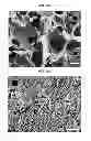 Fig. 18 - Multilayered silk scaffolds for meniscus tissue engineering