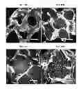 Fig. 19 - Multilayered silk scaffolds for meniscus tissue engineering
