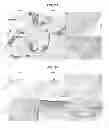 Fig. 22 - Multilayered silk scaffolds for meniscus tissue engineering