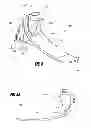 Fig. 04 - Prosthetic foot with resilient heel