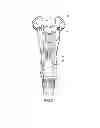 Fig. 04 - Automatic rod holder