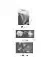 Fig. 05 - PLANT ARTIFICIAL SEEDS AND METHODS FOR THE PRODUCTION THEREOF