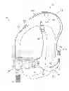 Fig. 01 - Ergonomic and adjustable respiratory mask assembly with elbow assembly