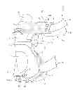 Fig. 01 - Breathing mask arrangement and a forehead support device for same