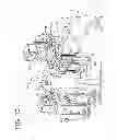 Fig. 11 - Method of securing a patient onto an operating table when the patient is in the trendelenburg position and apparatus therefor including a kit
