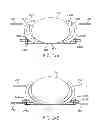 Fig. 17 - APPARATUS AND METHODS FOR CONFORMING A SUPPORT TO A BODY