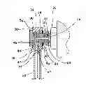 Fig. 01 - Bleeding system