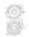 Fig. 04 - RUN-FLAT SUPPORT ASSEMBLY FOR A PNEUMATIC TIRED WHEEL AND METHOD FOR USE OF SAME