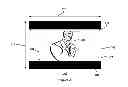 Fig. 05 - Pillarboxing Correction