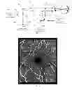 Fig. 03 - Data acquisition methods for reduced motion artifacts and applications in OCT angiography