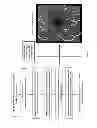 Fig. 05 - Data acquisition methods for reduced motion artifacts and applications in OCT angiography