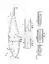 Fig. 04 - MULTI-MATERIAL RETROFITTED WIND TURBINE ROTOR BLADE AND METHODS FOR MAKING THE SAME
