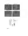 Fig. 11 - METHOD FOR ENHANCING EFFICACY AND SELECTIVITY OF CANCER CELL KILLING BY DNA DAMAGING AGENTS