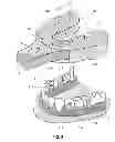 Fig. 07 - Shape memory dental retention systems