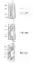 Fig. 32 - Shape memory dental retention systems