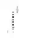 Fig. 02 - Tumor Suppressor Gene, p28ING5