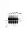 Fig. 06 - DNA sequence encoding a retinoic acid regulated protein