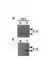 Fig. 08 - DNA sequence encoding a retinoic acid regulated protein