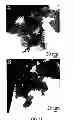 Fig. 07 - Method for removing strongly adsorbed surfactants and capping agents from metal to facilitate their catalytic applications