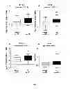 Fig. 02 - METHODS AND KITS FOR THE DIAGNOSIS OF PROSTATE CANCER