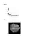 Fig. 02 - Hematological disorder diagnosis by 3D q-FISH