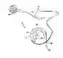 Fig. 01 - SMOOTH SURFACE GASTRIC BAND DEVICE AND SYSTEM