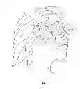 Fig. 02 - Integrated delivery and visualization tool for a neuromodulation system