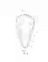 Fig. 02 - Protective cup
