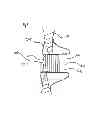 Fig. 07 - METHODS AND DEVICES FOR INTRA-ATRIAL SHUNTS HAVING ADJUSTABLE SIZES