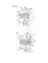 Fig. 09 - METHODS AND DEVICES FOR INTRA-ATRIAL SHUNTS HAVING ADJUSTABLE SIZES