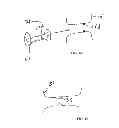 Fig. 15 - METHODS AND DEVICES FOR INTRA-ATRIAL SHUNTS HAVING ADJUSTABLE SIZES