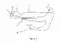 Fig. 02 - Apparatus for Administering Therapy at a Remote Location in the Body