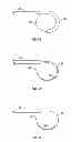 Fig. 06 - MICROWAVE ANTENNA HAVING A CURVED CONFIGURATION