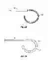 Fig. 08 - MICROWAVE ANTENNA HAVING A CURVED CONFIGURATION